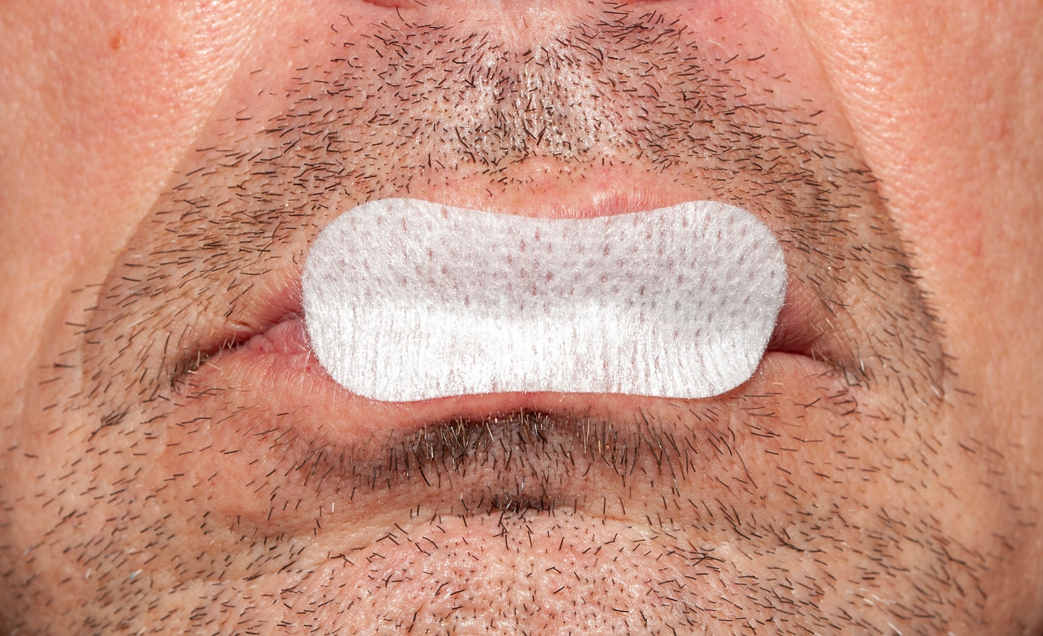 1 x De Næsvises Mundtape